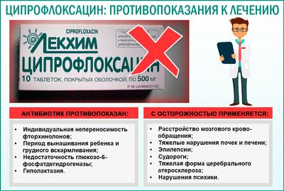 Противопоказания к применению препарата «Ципрофлаксин»