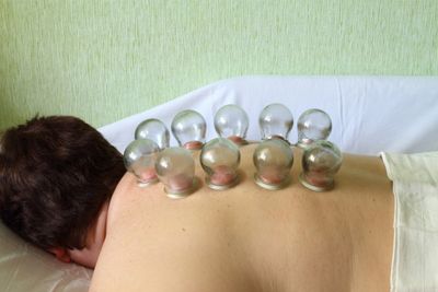банки на спине у девушки