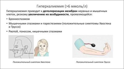 Клинические признаки повышений концентрации калия в плазме крови