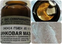 Для чего применяют цинковую мазь