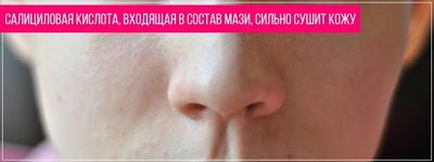 Салициловая кислота при передозировке пересушивает кожу