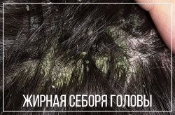 Себорея на голове