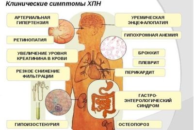 симптомы хпн
