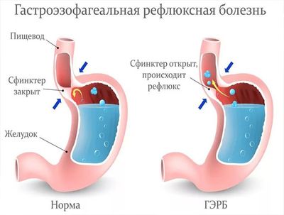 95