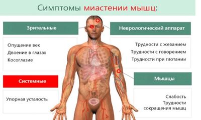 симптомы миостении