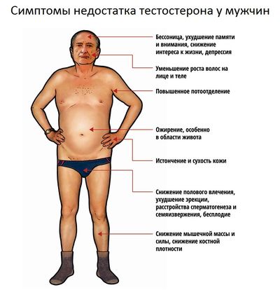 симптомы недостатка тестостерона