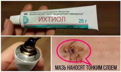 рекомендации по нанесению мази ихтиол