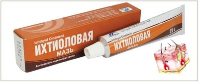 Ихтиоловая мазь помогает устранить фурункулы