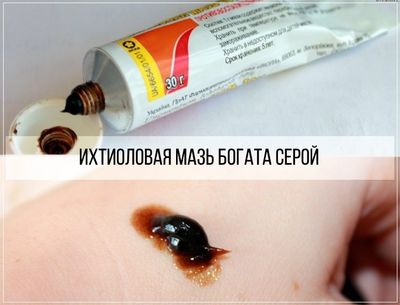 Ихтиоловая мазь богата серой, которая подавляет жизнедеятельность патогенной микрофлоры
