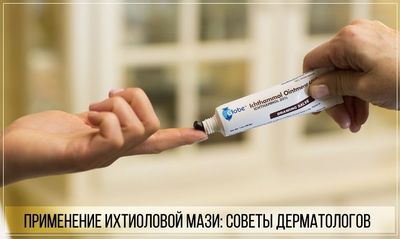 Как правильно наносить ихтиоловую мазь