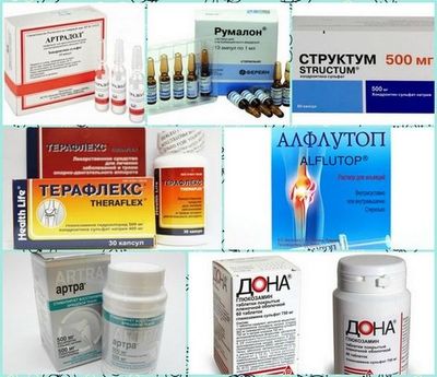 Пациенту назначаются хондропротекторы