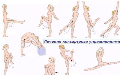 В домашних условиях пациенту рекомендовано заниматься ЛФК