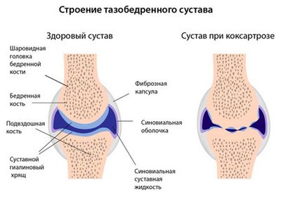 Благодаря гиалиновому хрящу, суставы могут «скользить»