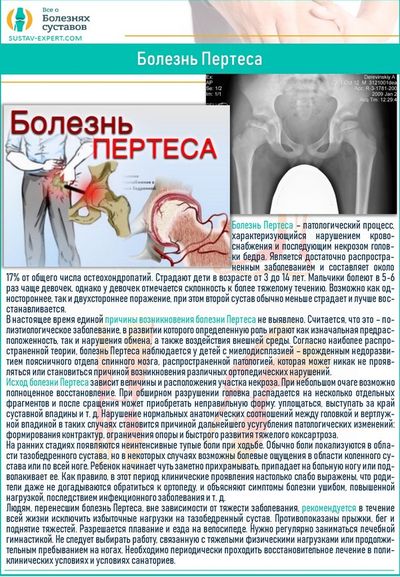 Болезнь Пертеса