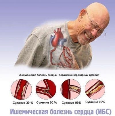 Опасное заболевание