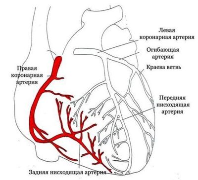 Схема