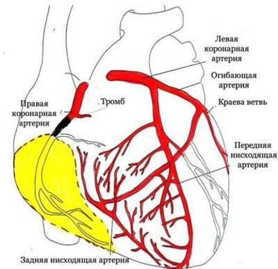 Опасная ситуация