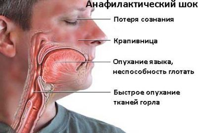 Опасно для жизни!