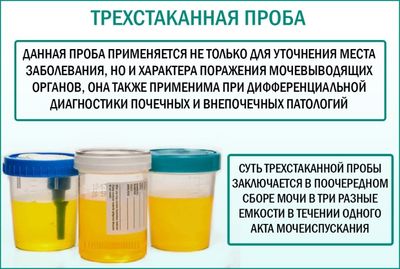 Анализ мочи