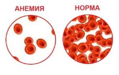 Пищевое отравление