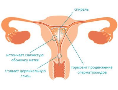 Когда ставят спираль - до месячных или после