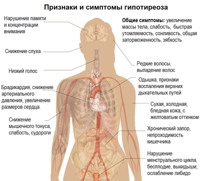 Симптомы гипотереоза