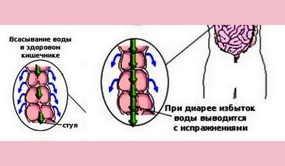 Причины и способы лечения поноса с запахом тухлых яиц у ребенка