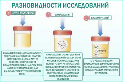 Исследования мочи
