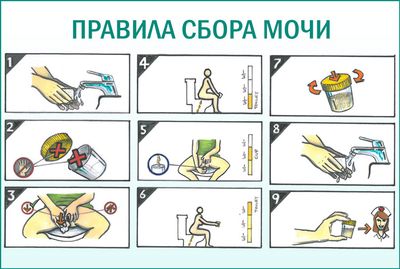 Сбор мочи на анализ