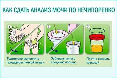 Как сдать анализ мочи по Нечипоренко