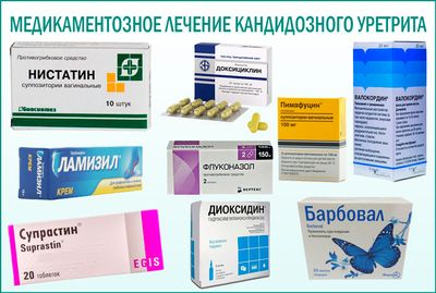 Кандидозный уретрит: медикаментозное лечение