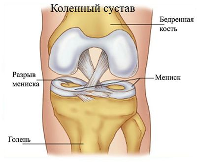 Строение сустава