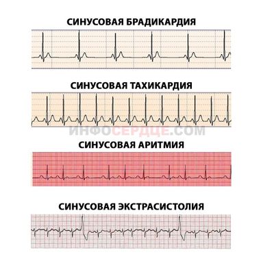 Варианты нарушений
