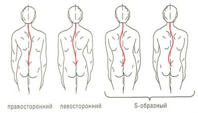 спина