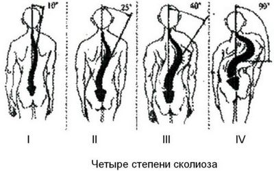 спина