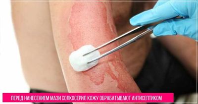 Перед применением мази солкосерил кожу аккуратно обрабатывают антисептиком