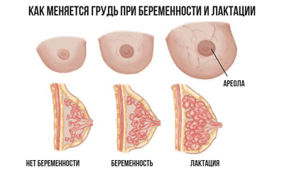 грудь при беременности