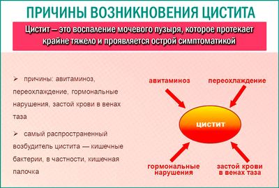 Таблетки, которые назначают при лечении мочевого пузыря