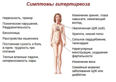 симптомы гипертиреоза