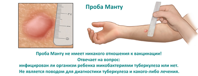 проба манту