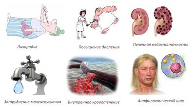 Побочные явления Мелоксикама