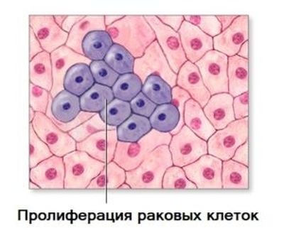 Пролиферация