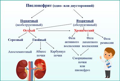 Пиелонефрит: виды