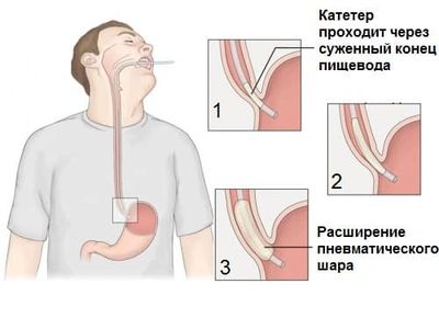 Лечение