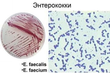 энтерококки