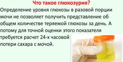 Правила сбора мочи на сахар, расшифровка результатов