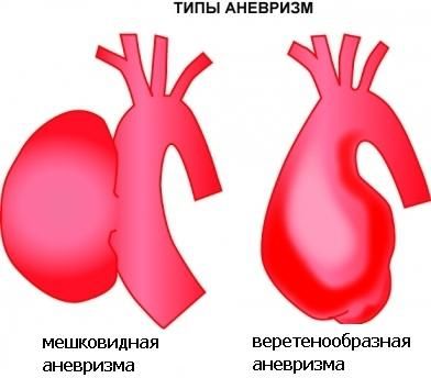 Типы патологии