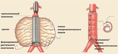 Хирургическое лечение