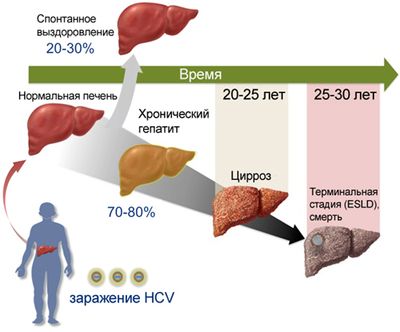 Что означает выявление в крови антител к гепатиту С?