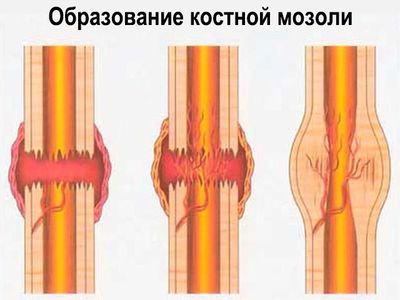 Схематический рисунок